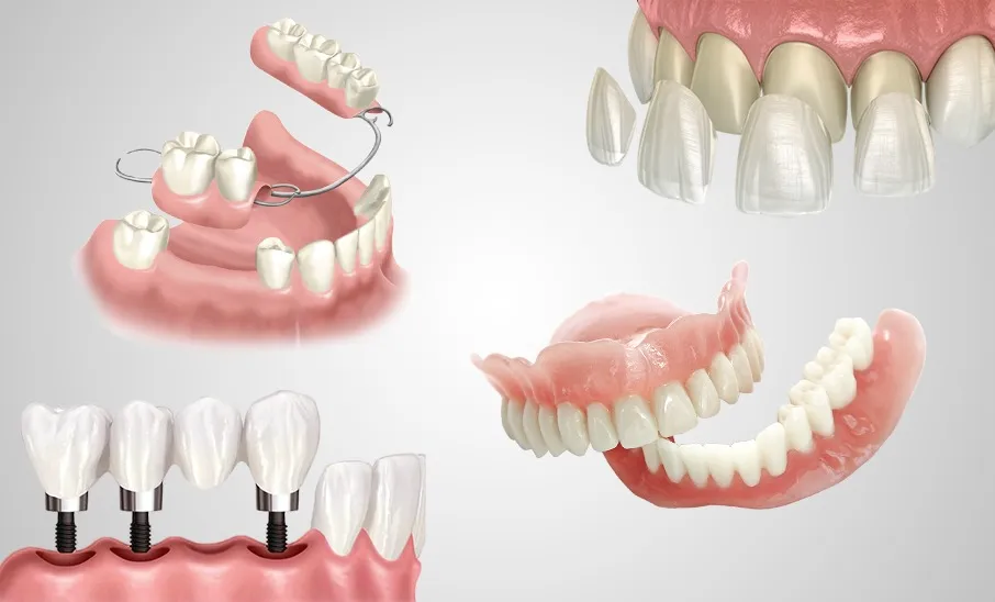 تخصص الاستعاضات السنية المتحركة